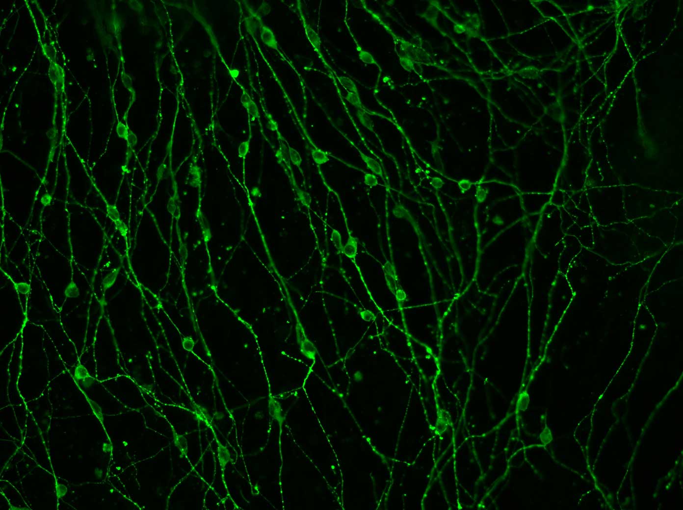 BIII-Tubulin_ABCAM_01-1_ch01-kompr