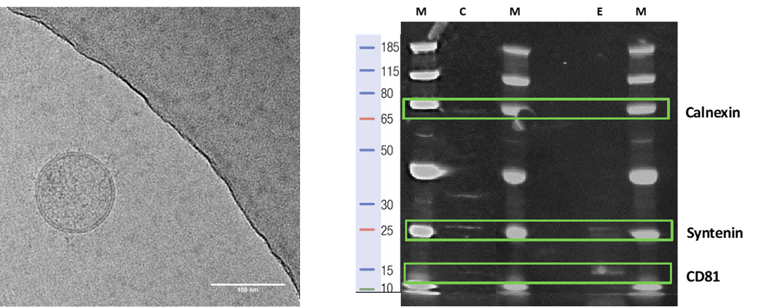 Electron microscopy and western blotting_WJ_MSC_TERT273