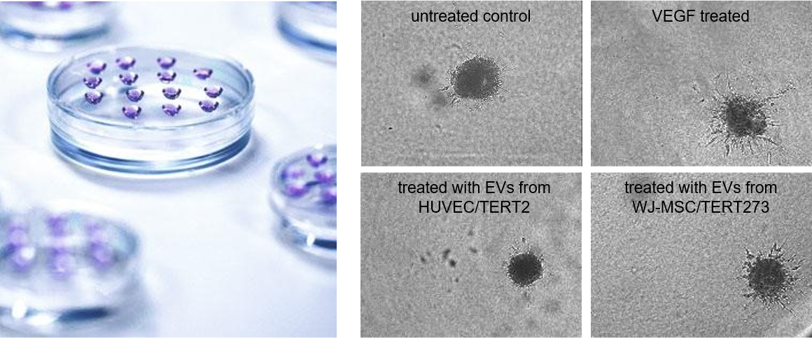 Monitoring sprout formation upon EV treatment_WJ_MSC_TERT273