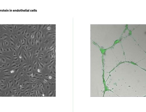 Overexpression of green fluorescent protein in endothelial cells