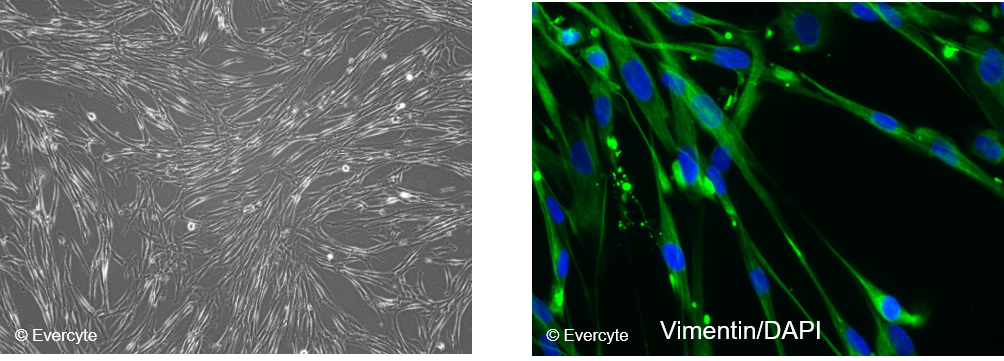 fHDF-TERT166 Morphology