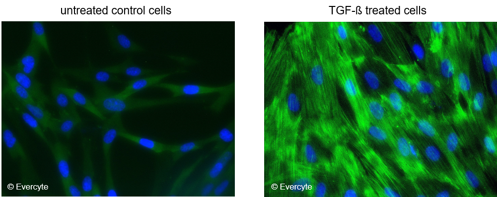 fHDF-TERT166 Myofibroblast differentiation