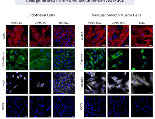 Recently published article on generating endothelial and vascular smooth muscle cells from PBMC and urine-derived iPSCs